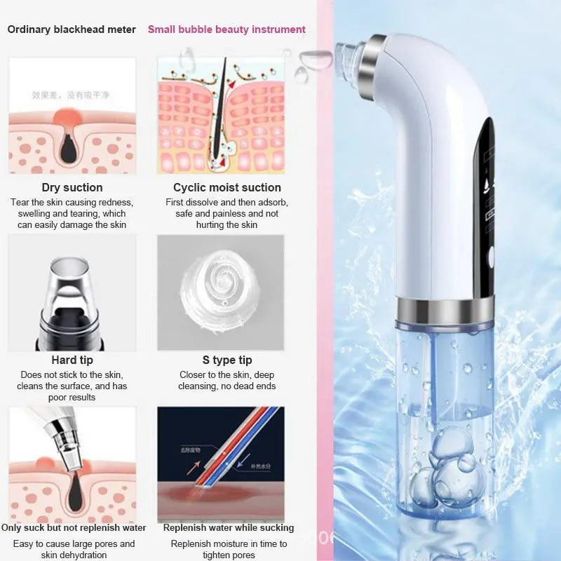 Electric Blackhead Vacuum Remover Health & Beauty-5